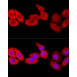 Immunofluorescence - Anti-MRP8 Antibody (A88014) - Antibodies.com