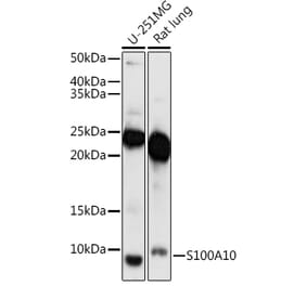 Western Blot - Anti-S100A10 Antibody (A88015) - Antibodies.com