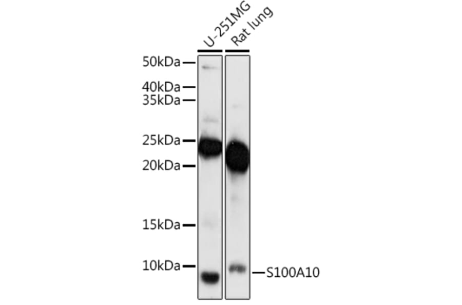 Western Blot - Anti-S100A10 Antibody (A88015) - Antibodies.com