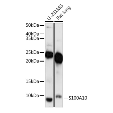 Western Blot - Anti-S100A10 Antibody (A88015) - Antibodies.com