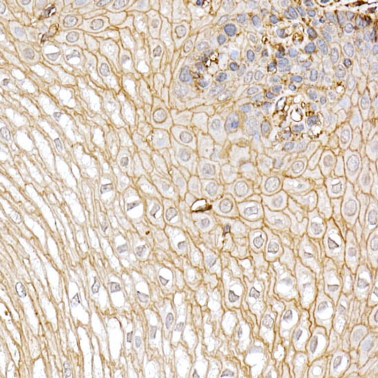 Immunohistochemistry - Anti-S100A10 Antibody (A88015) - Antibodies.com