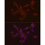 Immunofluorescence - Anti-S100A10 Antibody (A88015) - Antibodies.com