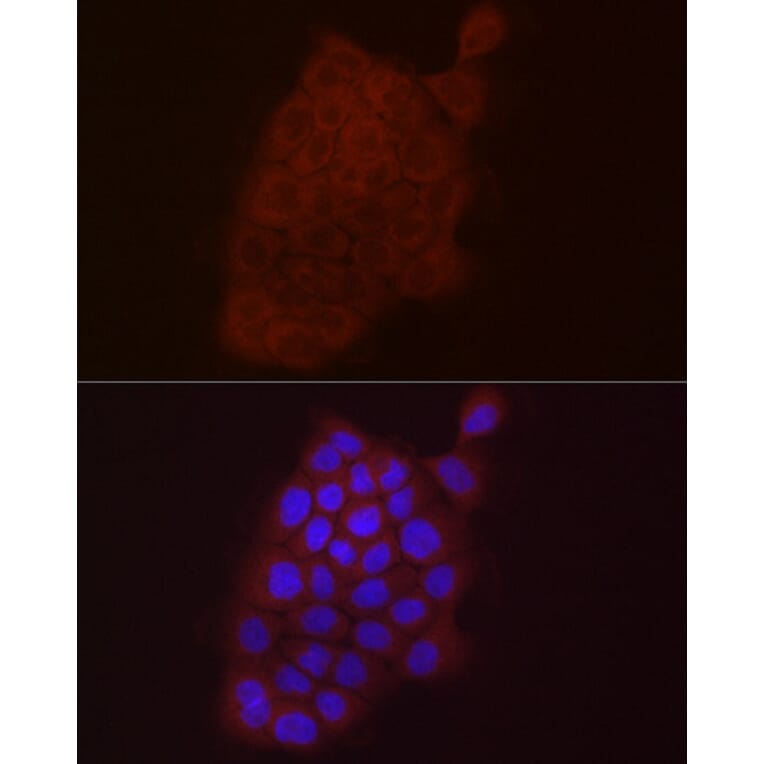 Immunofluorescence - Anti-S100A10 Antibody (A88015) - Antibodies.com