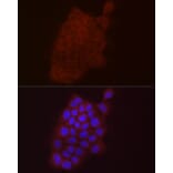 Immunofluorescence - Anti-S100A10 Antibody (A88015) - Antibodies.com