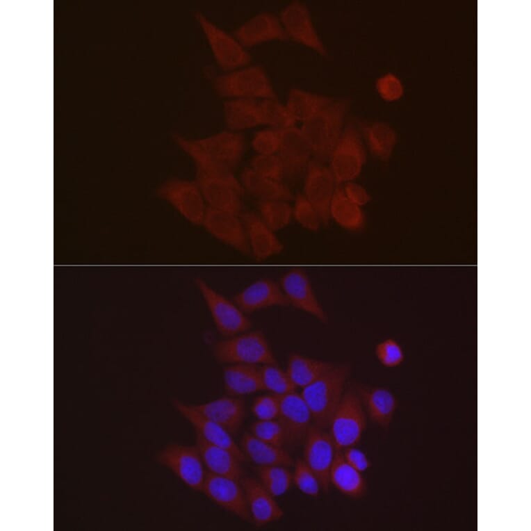 Immunofluorescence - Anti-S100A10 Antibody (A88015) - Antibodies.com