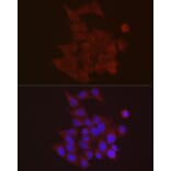 Immunofluorescence - Anti-S100A10 Antibody (A88015) - Antibodies.com