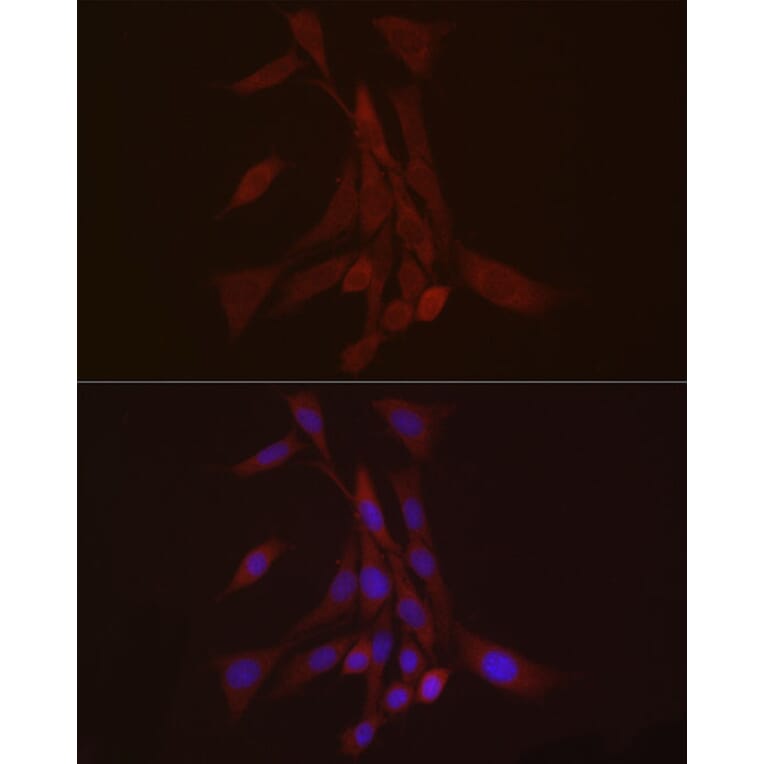 Immunofluorescence - Anti-S100A10 Antibody (A88015) - Antibodies.com