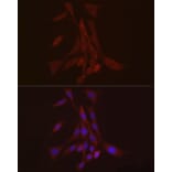Immunofluorescence - Anti-S100A10 Antibody (A88015) - Antibodies.com