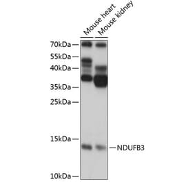 Western Blot - Anti-NDUFB3 Antibody (A88016) - Antibodies.com