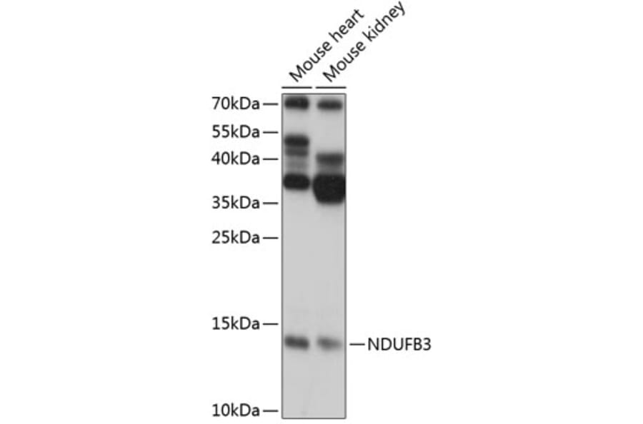 Western Blot - Anti-NDUFB3 Antibody (A88016) - Antibodies.com