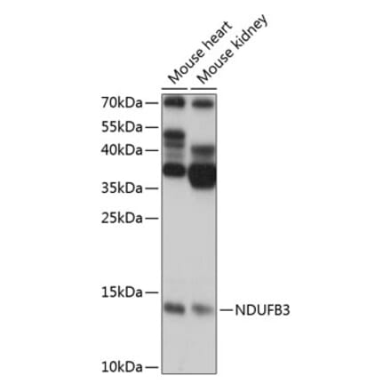 Western Blot - Anti-NDUFB3 Antibody (A88016) - Antibodies.com