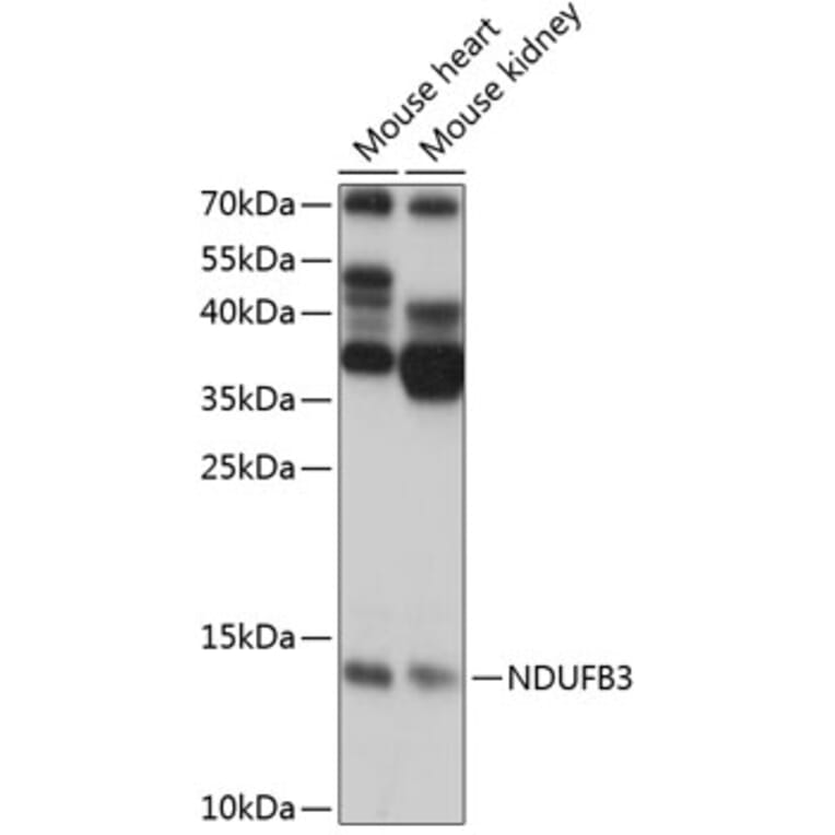 Western Blot - Anti-NDUFB3 Antibody (A88016) - Antibodies.com