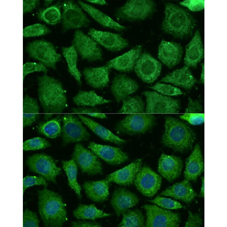 Immunofluorescence - Anti-NDUFB3 Antibody (A88016) - Antibodies.com