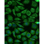 Immunofluorescence - Anti-NDUFB3 Antibody (A88016) - Antibodies.com