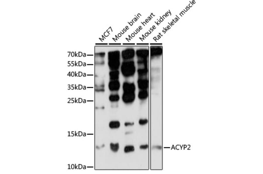 Western Blot - Anti-ACYP2 Antibody (A15636) - Antibodies.com