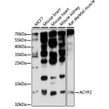 Western Blot - Anti-ACYP2 Antibody (A15636) - Antibodies.com