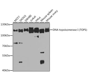 Western Blot - Anti-Topoisomerase I Antibody (A88019) - Antibodies.com