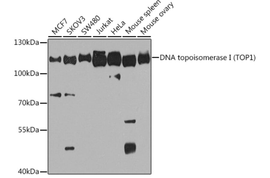 Western Blot - Anti-Topoisomerase I Antibody (A88019) - Antibodies.com