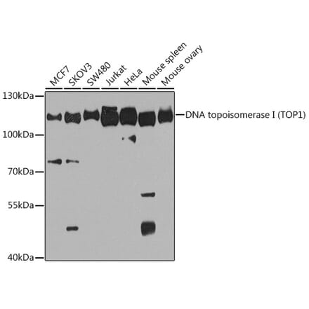 Western Blot - Anti-Topoisomerase I Antibody (A88019) - Antibodies.com