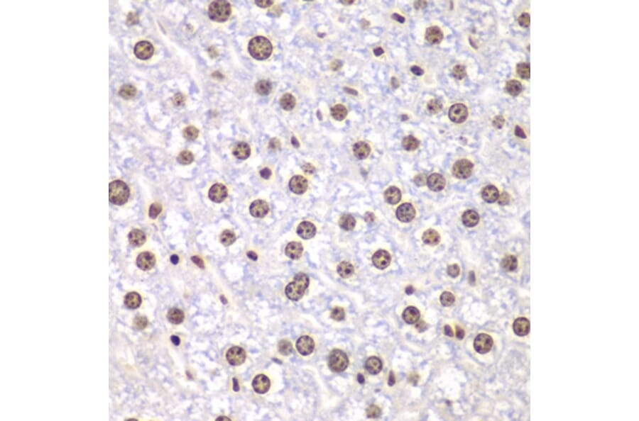 Immunohistochemistry - Anti-Topoisomerase I Antibody (A88019) - Antibodies.com