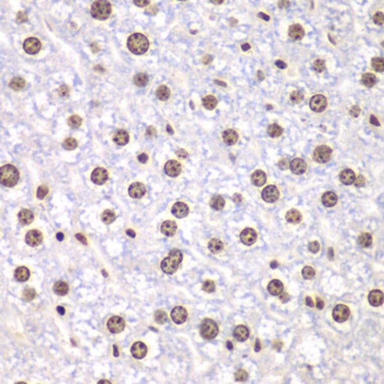 Immunohistochemistry - Anti-Topoisomerase I Antibody (A88019) - Antibodies.com