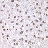 Immunohistochemistry - Anti-Topoisomerase I Antibody (A88019) - Antibodies.com