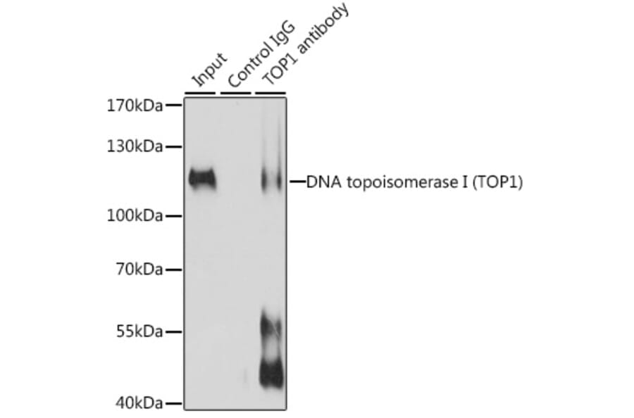 Western Blot - Anti-Topoisomerase I Antibody (A88019) - Antibodies.com