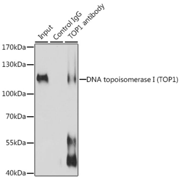 Western Blot - Anti-Topoisomerase I Antibody (A88019) - Antibodies.com