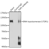 Western Blot - Anti-Topoisomerase I Antibody (A88019) - Antibodies.com