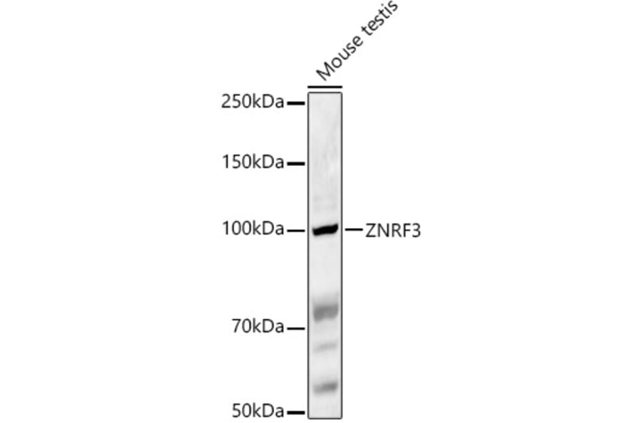 Western Blot - Anti-ZNRF3 Antibody (A88020) - Antibodies.com