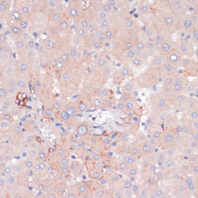 Immunohistochemistry - Anti-ZNRF3 Antibody (A88020) - Antibodies.com