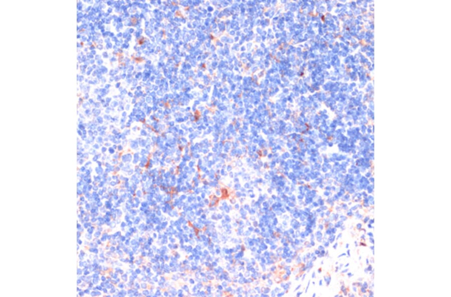 Immunohistochemistry - Anti-ZNRF3 Antibody (A88020) - Antibodies.com
