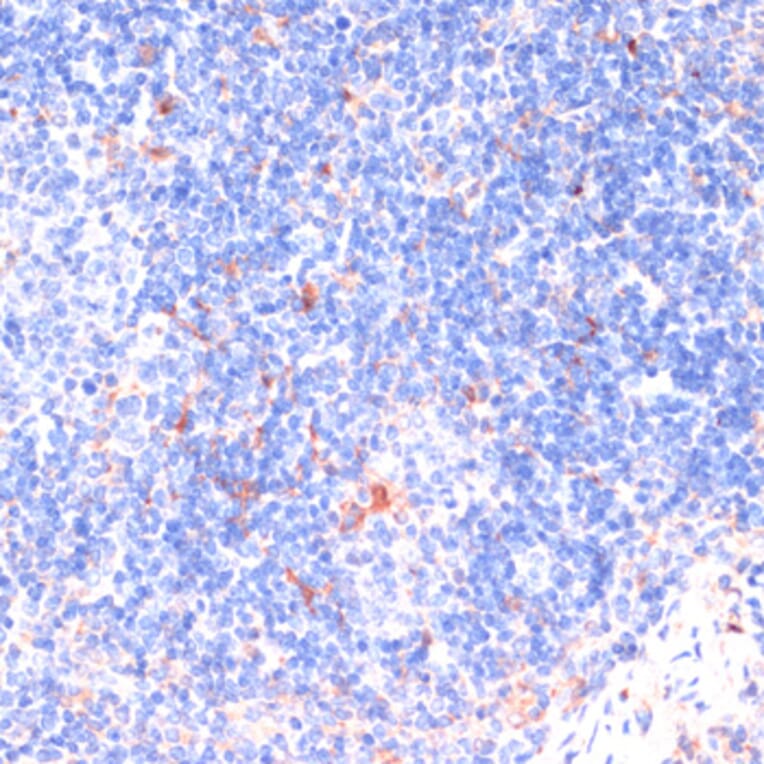 Immunohistochemistry - Anti-ZNRF3 Antibody (A88020) - Antibodies.com