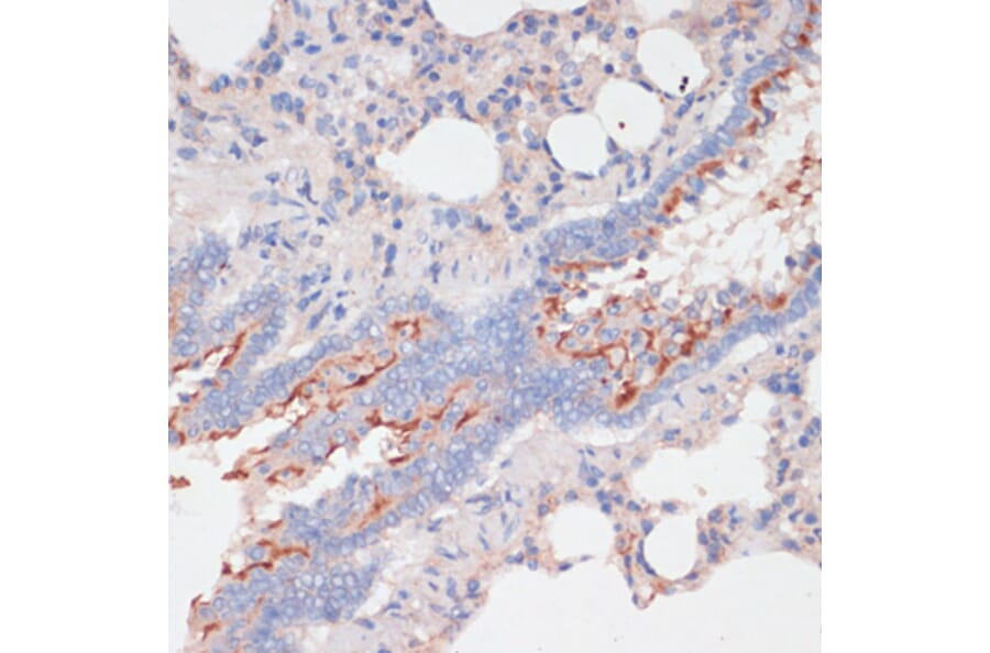 Immunohistochemistry - Anti-ZNRF3 Antibody (A88020) - Antibodies.com