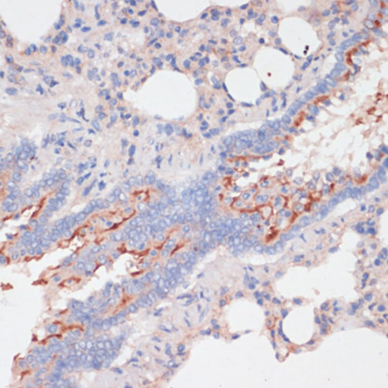 Immunohistochemistry - Anti-ZNRF3 Antibody (A88020) - Antibodies.com