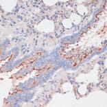 Immunohistochemistry - Anti-ZNRF3 Antibody (A88020) - Antibodies.com