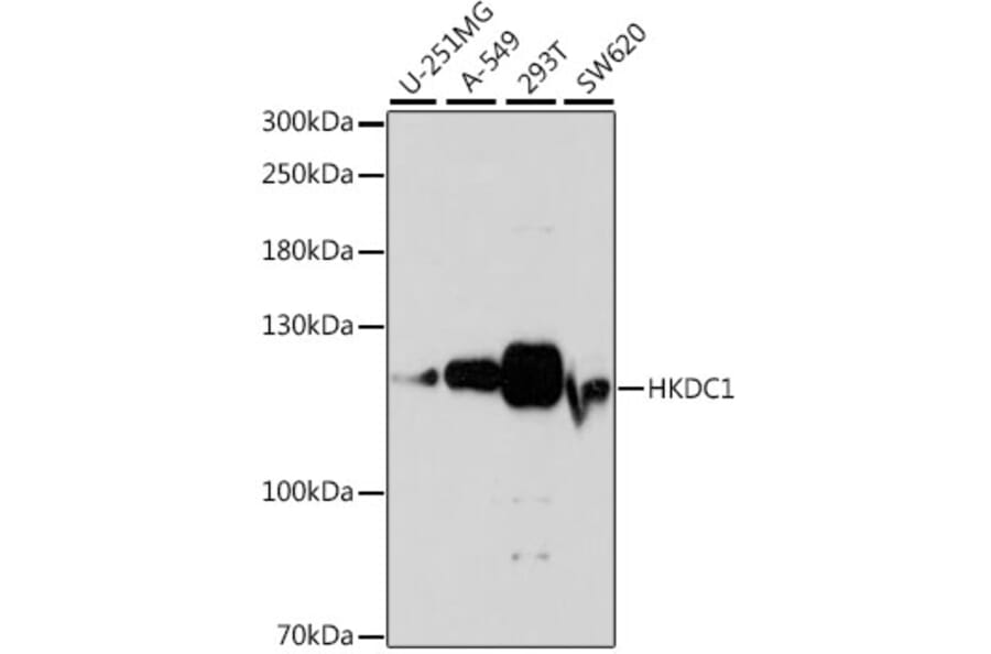 Western Blot - Anti-HKDC1 Antibody (A88021) - Antibodies.com
