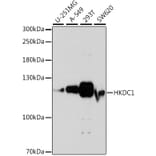 Western Blot - Anti-HKDC1 Antibody (A88021) - Antibodies.com