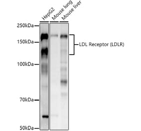 Western Blot - Anti-LDL Receptor Antibody (A88023) - Antibodies.com