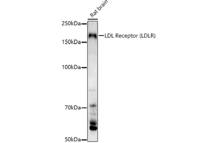Western Blot - Anti-LDL Receptor Antibody (A88023) - Antibodies.com
