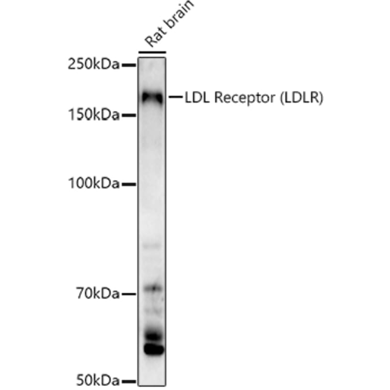 Western Blot - Anti-LDL Receptor Antibody (A88023) - Antibodies.com