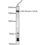 Western Blot - Anti-LDL Receptor Antibody (A88023) - Antibodies.com