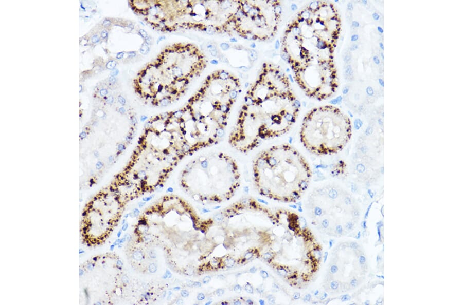 Immunohistochemistry - Anti-LDL Receptor Antibody (A88023) - Antibodies.com