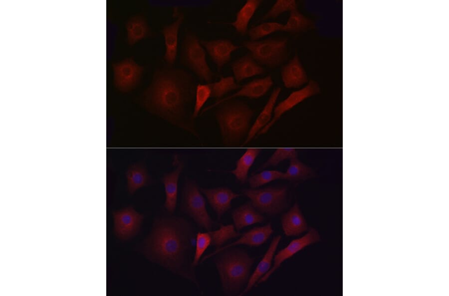 Immunofluorescence - Anti-LDL Receptor Antibody (A88023) - Antibodies.com