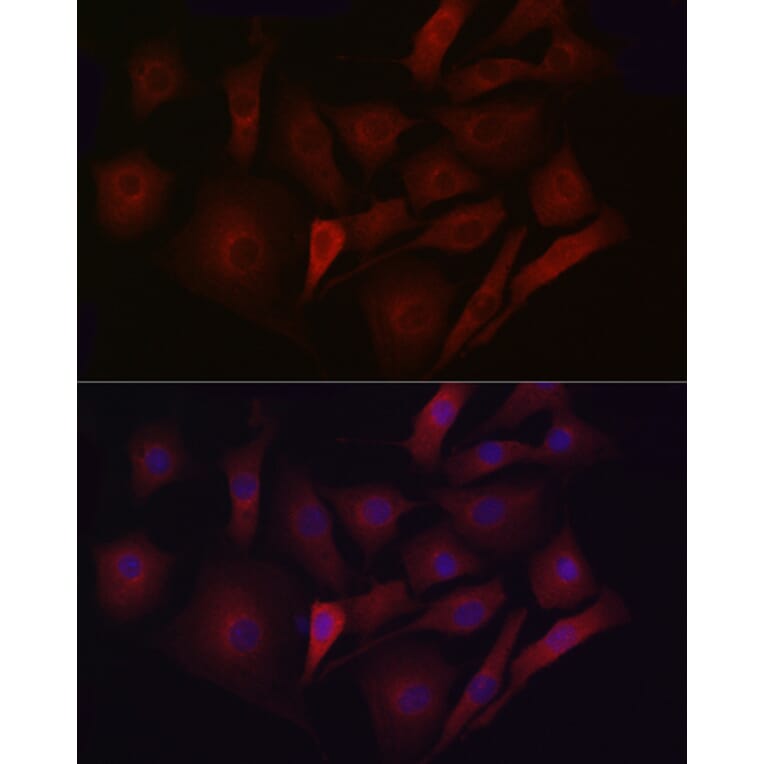 Immunofluorescence - Anti-LDL Receptor Antibody (A88023) - Antibodies.com