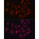 Immunofluorescence - Anti-LDL Receptor Antibody (A88023) - Antibodies.com