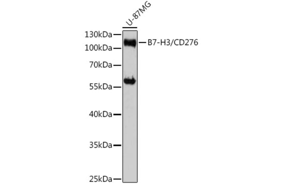 Western Blot - Anti-CD276 Antibody (A88024) - Antibodies.com