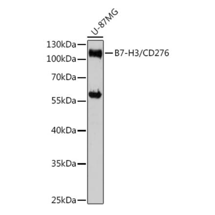 Western Blot - Anti-CD276 Antibody (A88024) - Antibodies.com