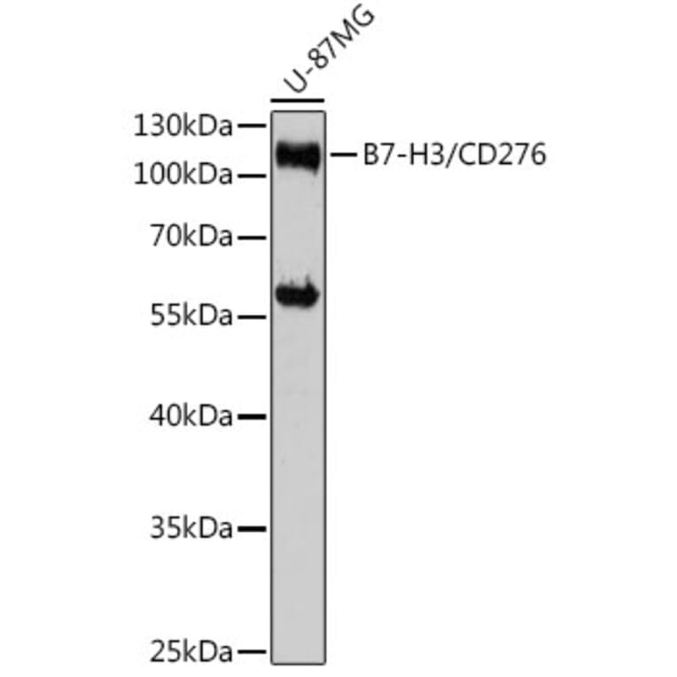 Western Blot - Anti-CD276 Antibody (A88024) - Antibodies.com