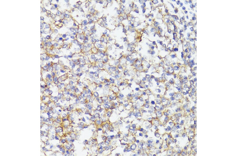 Immunohistochemistry - Anti-CD276 Antibody (A88024) - Antibodies.com